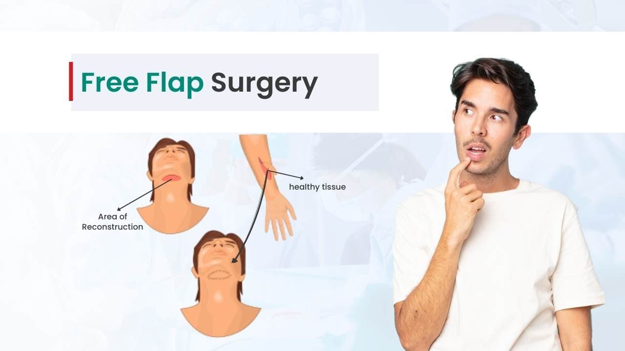 Free Flap Surgery