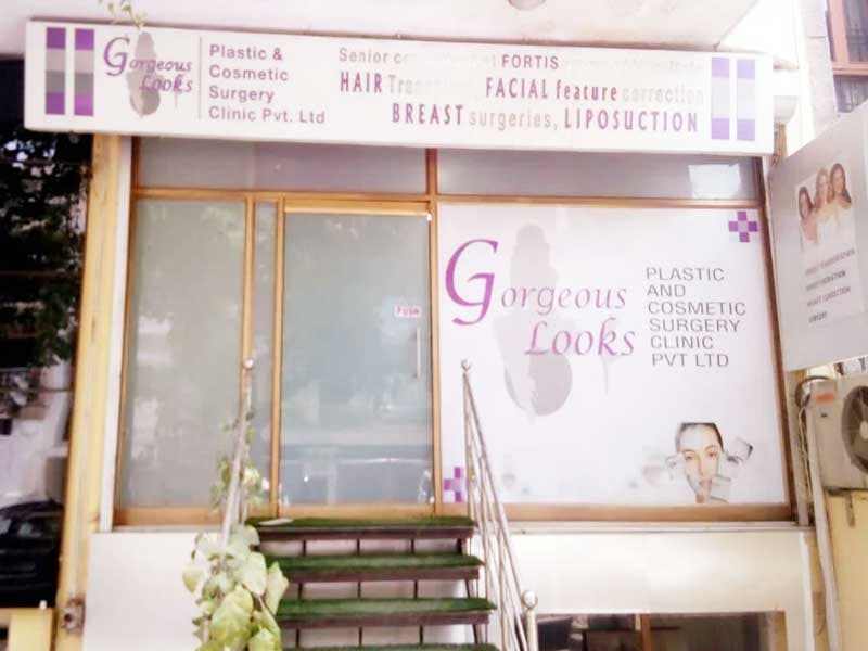 অসাধারণ কসমেটিক সার্জারি