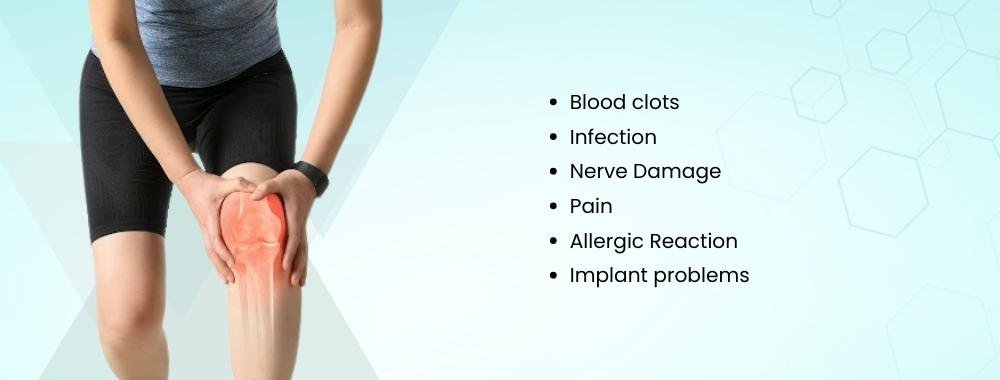 potential risks and side effects of knee arthroplasty surgery