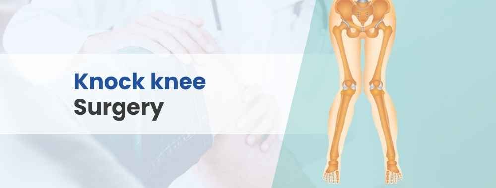 knock knee surgery
