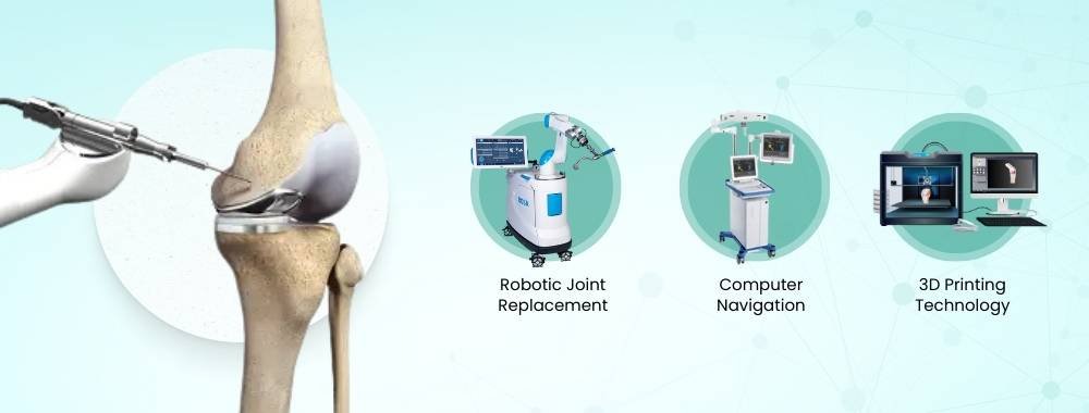 technology used in knee arthroplasty in india