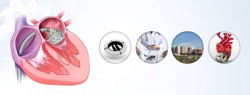 Factors Affect the Cost of Mitral Valve Replacement in India