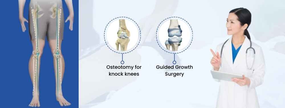 types of knock knee surgery