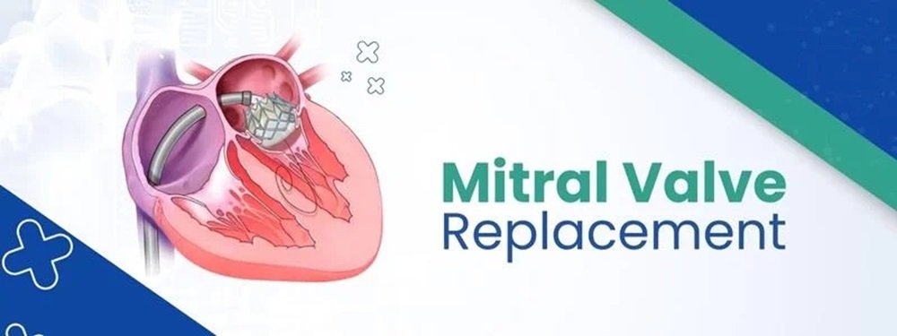 mitral valve replacement cost in india