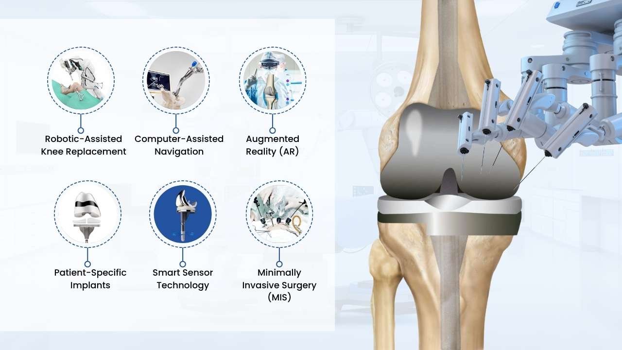 technology used in total knee replacement
